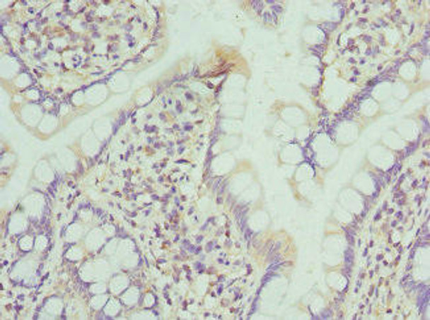 NMU Antibody (PACO44430)
