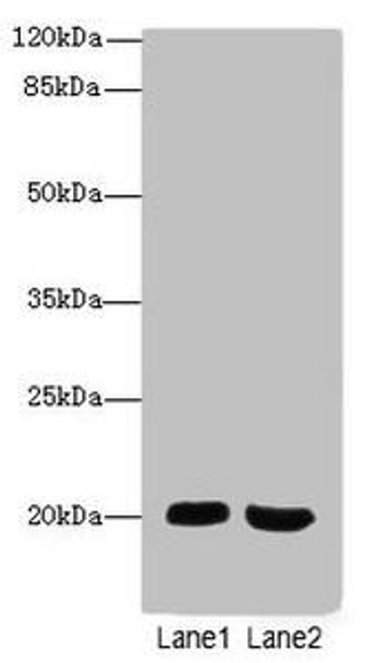 MSRB2 Antibody (PACO44448)
