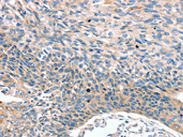 MUC1 Antibody (PACO20307)