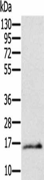 Ly6a Antibody (PACO20398)