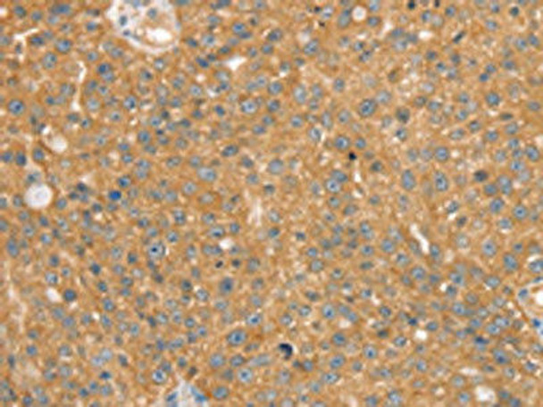 SNX2 Antibody (PACO20565)