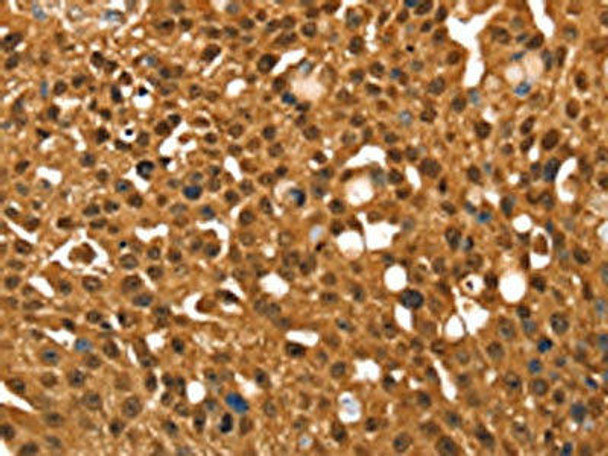 SRGAP1 Antibody (PACO20600)