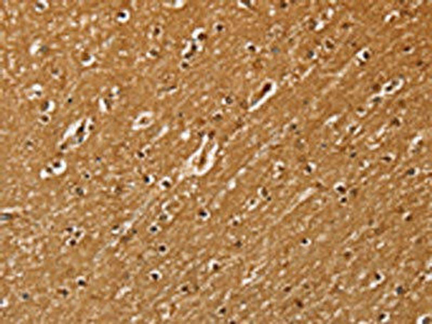 SSX2 Antibody (PACO20605)