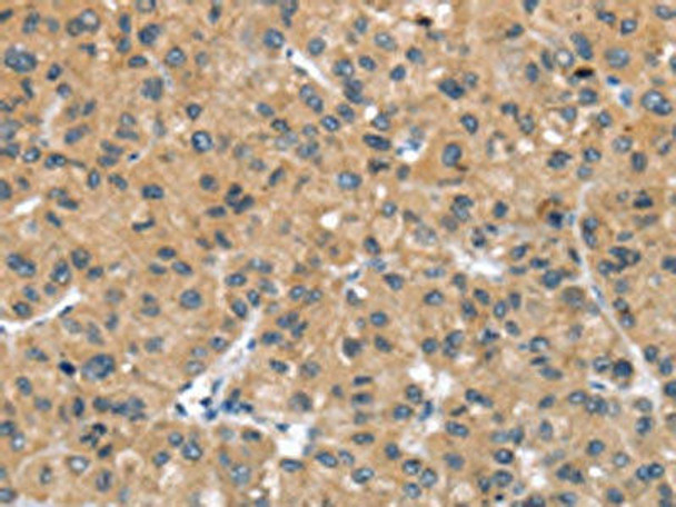 UCP3 Antibody (PACO20818)