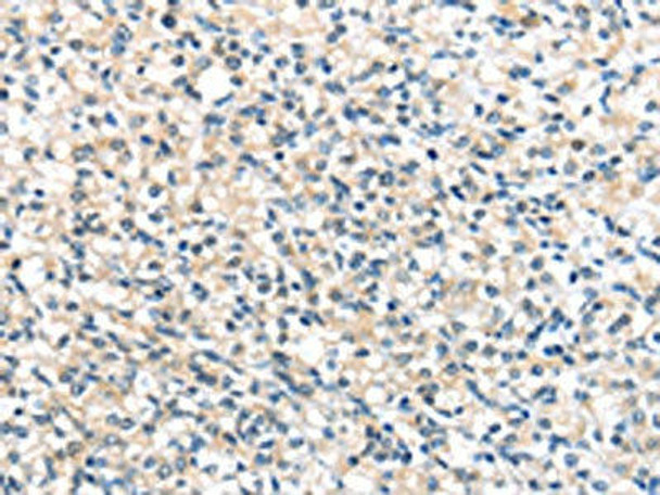 UCP3 Antibody (PACO20819)