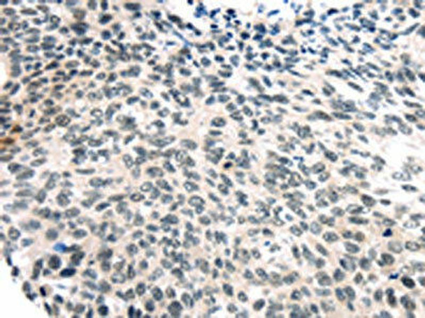 USP7 Antibody (PACO20830)