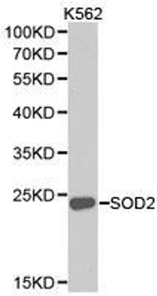 SOD2 Antibody (PACO21127)