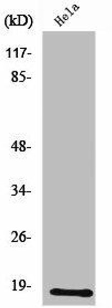 UBE2D2 Antibody (PACO01672)