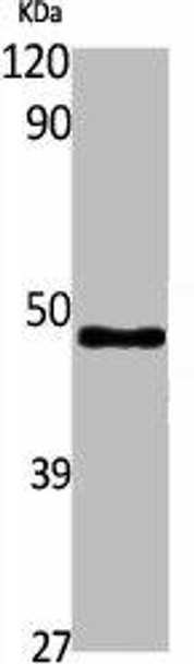 ACADM Antibody (PACO01743)