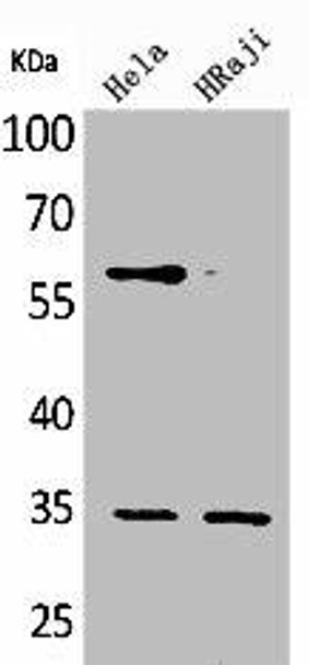 FCGR2B Antibody (PACO01843)