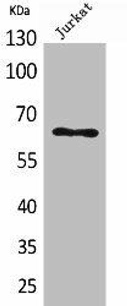 KRT2 Antibody (PACO02025)