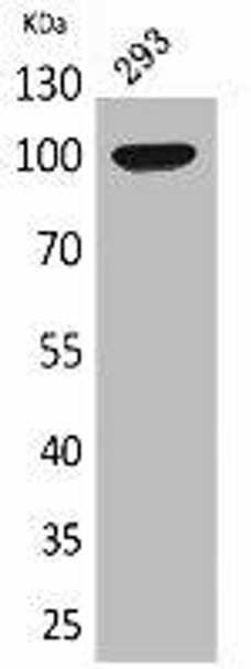 ENPP2 Antibody (PACO02047)