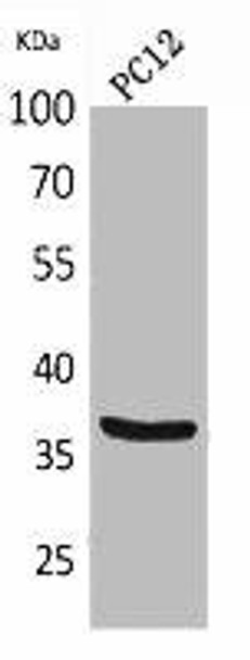 BST1 Antibody (PACO02151)