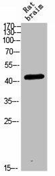 CRHR2 Antibody (PACO07319)
