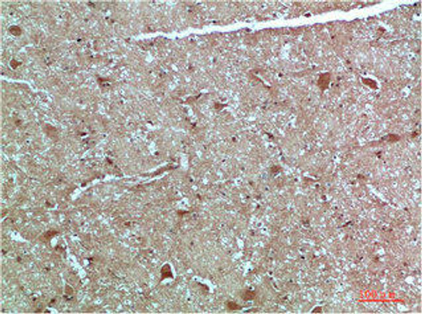 ATG4C Antibody (PACO07469)