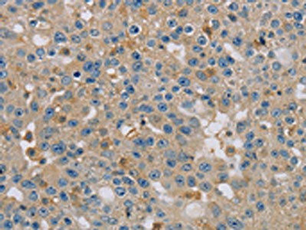 CLIC1 Antibody (PACO16736)