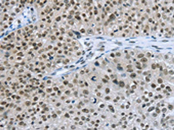 ZMAT3 Antibody (PACO16825)