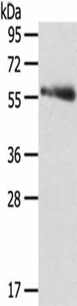 SRPK3 Antibody (PACO17170)