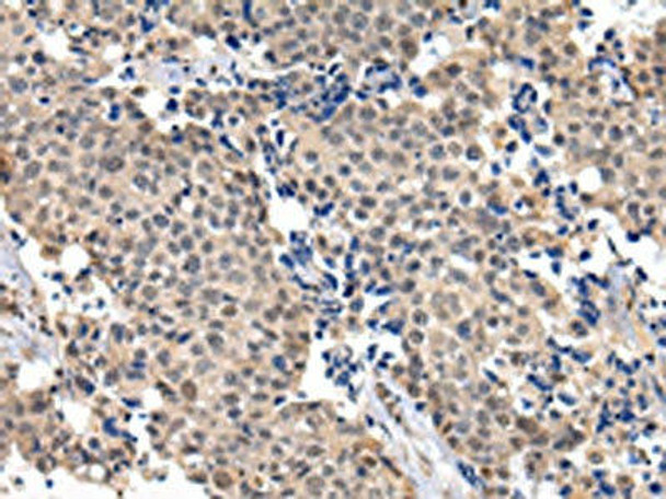 USF1 Antibody (PACO17392)