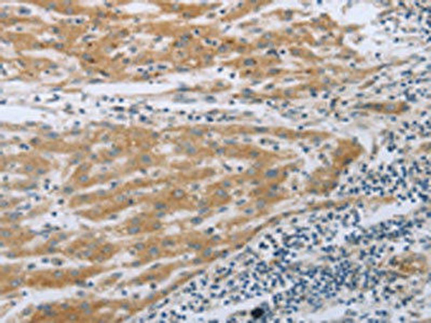 TNK2 Antibody (PACO17487)