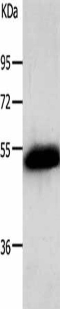 ADRB2 Antibody (PACO17497)