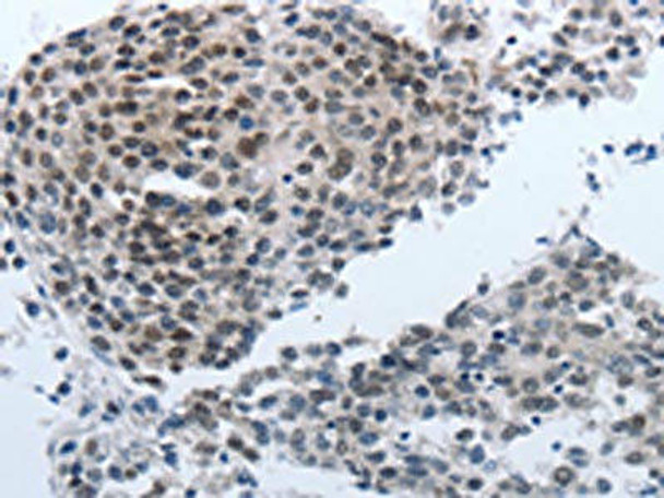 NPR1 Antibody (PACO17588)