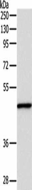 INHBA Antibody (PACO17606)