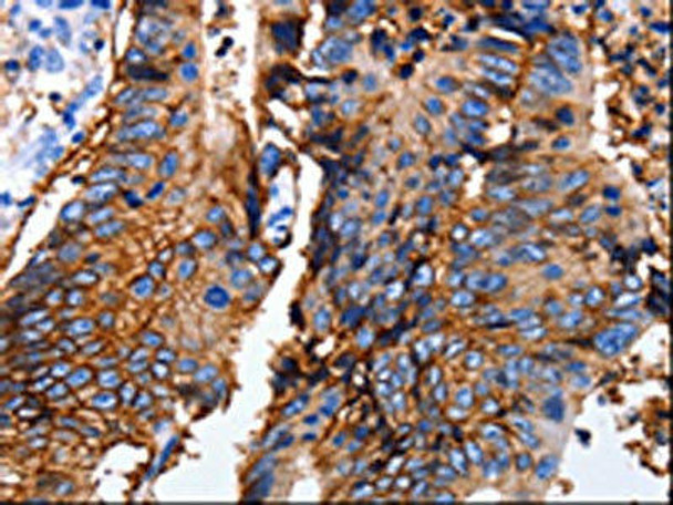 EPCAM Antibody (PACO17851)