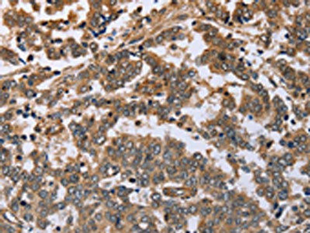 FAF1 Antibody (PACO17854)