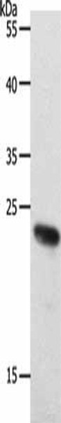 RAMP2 Antibody (PACO18362)