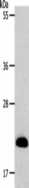 SIRT5 Antibody (PACO18397)