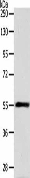 HNF1A Antibody (PACO18447)