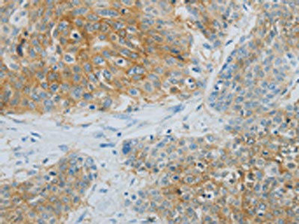 NDRG1 Antibody (PACO18729)