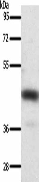 SSTR2 Antibody (PACO18928)