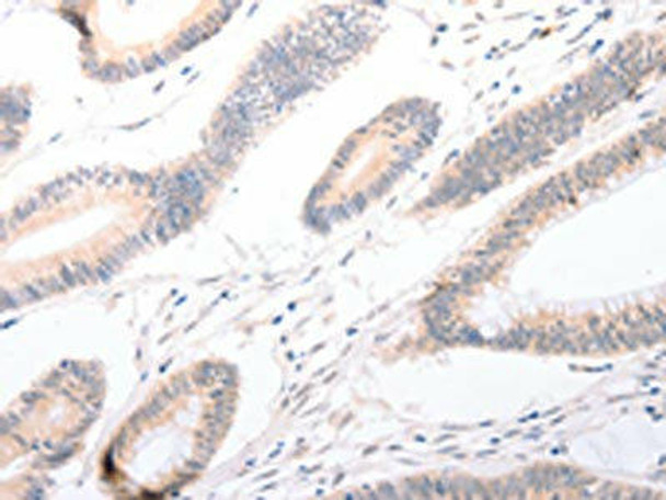 CELSR2 Antibody (PACO19033)