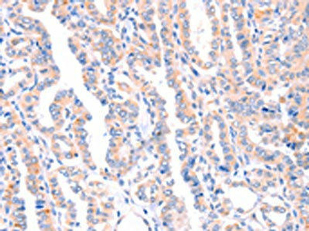 AMPD1 Antibody (PACO19102)