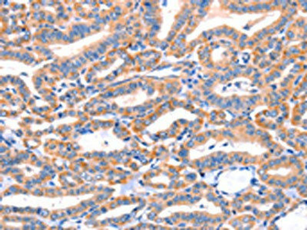 AP1B1 Antibody (PACO19110)