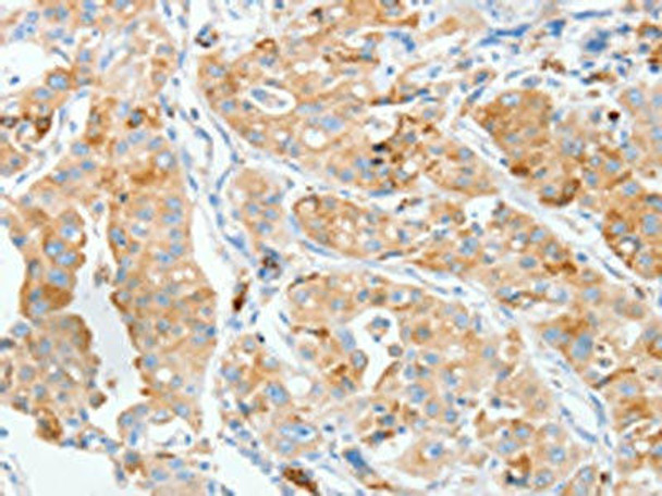 MANF Antibody (PACO19140)