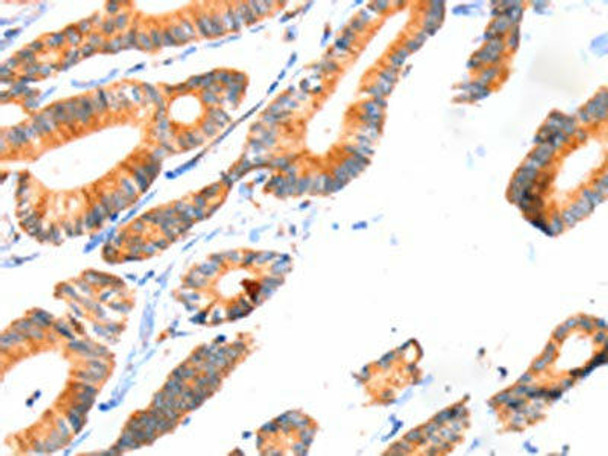 SCNN1A Antibody (PACO19278)