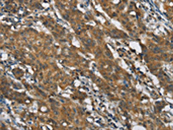 TLR6 Antibody (PACO19292)