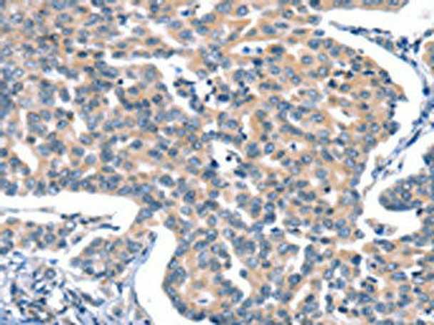 CACNA1A Antibody (PACO19377)