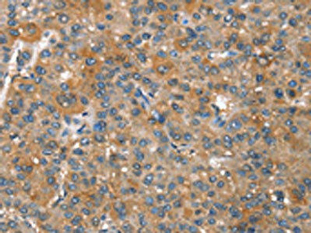 CAPZA1 Antibody (PACO19386)