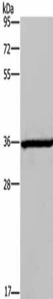 DIO2 Antibody (PACO19574)