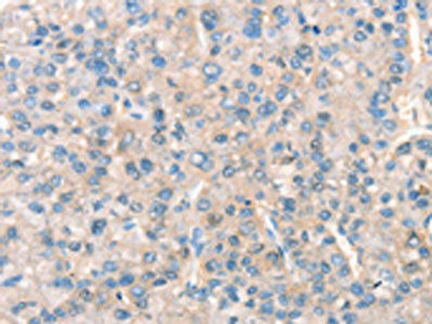 KCNB1 Antibody (PACO19584)