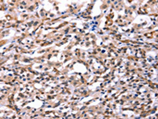 GCG Antibody (PACO19636)