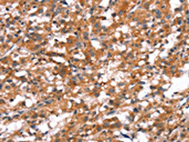 SLC6A1 Antibody (PACO19683)