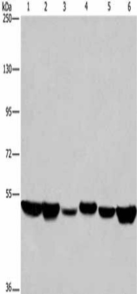 HNRNPH1 Antibody (PACO19772)