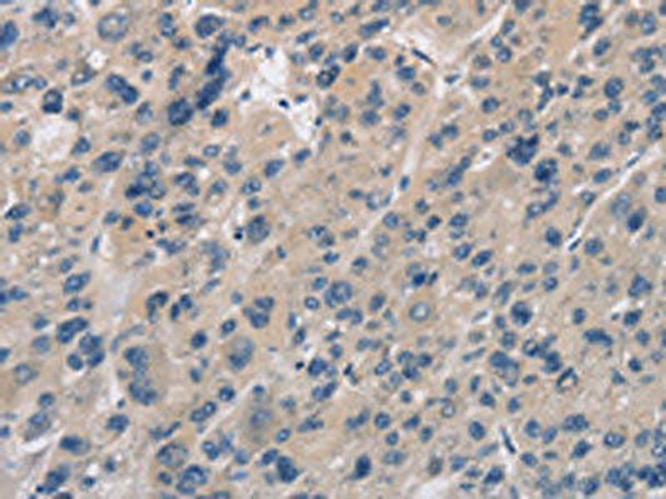 IMPDH1 Antibody (PACO19840)