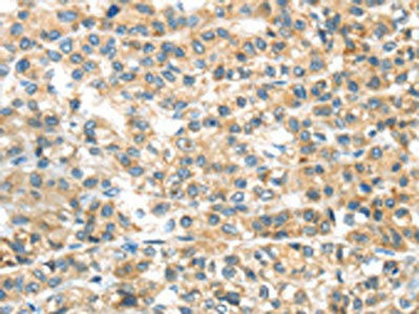 PLAGL2 Antibody (PACO20238)