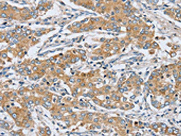 PTGER2 Antibody (PACO20276)